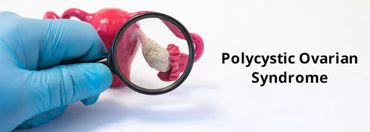 What is PCOS? Everything you should know about PCOS