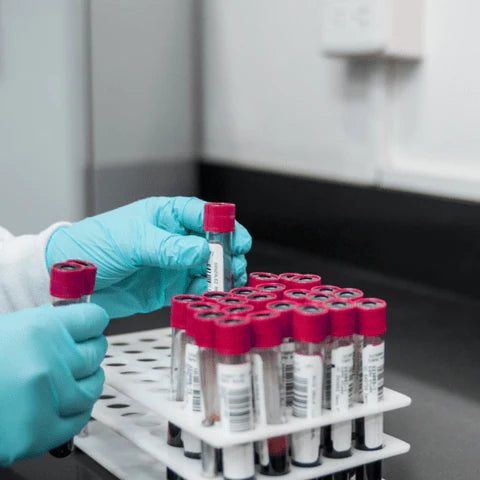12 Annual Blood Tests Every Woman Should Do